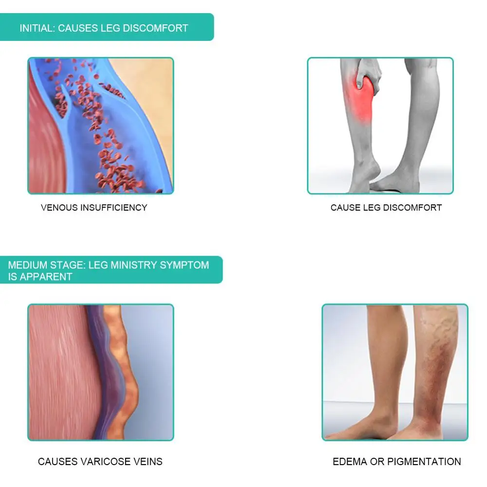 1 par meias de compressão médi - Compression Sock Medical avaliação e preço